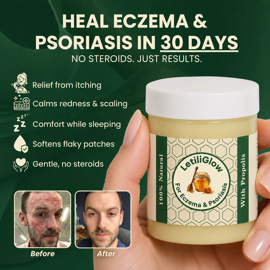 LetiliSkin - Repair Balm For Eczema & Psoriasis