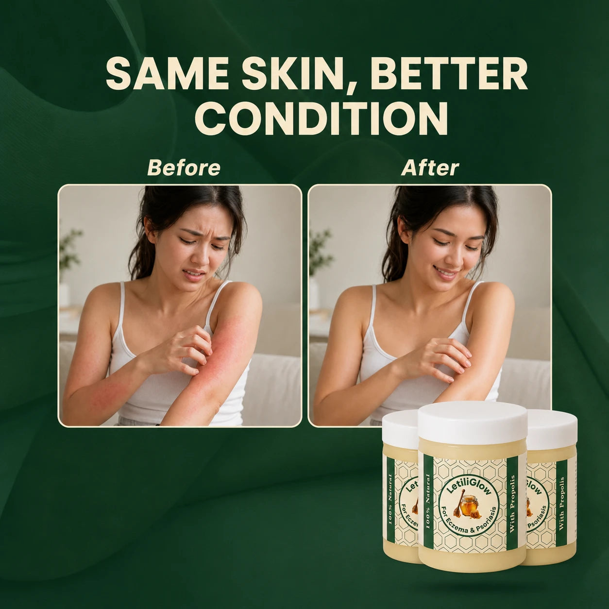 LetiliSkin - Repair Balm For Eczema & Psoriasis