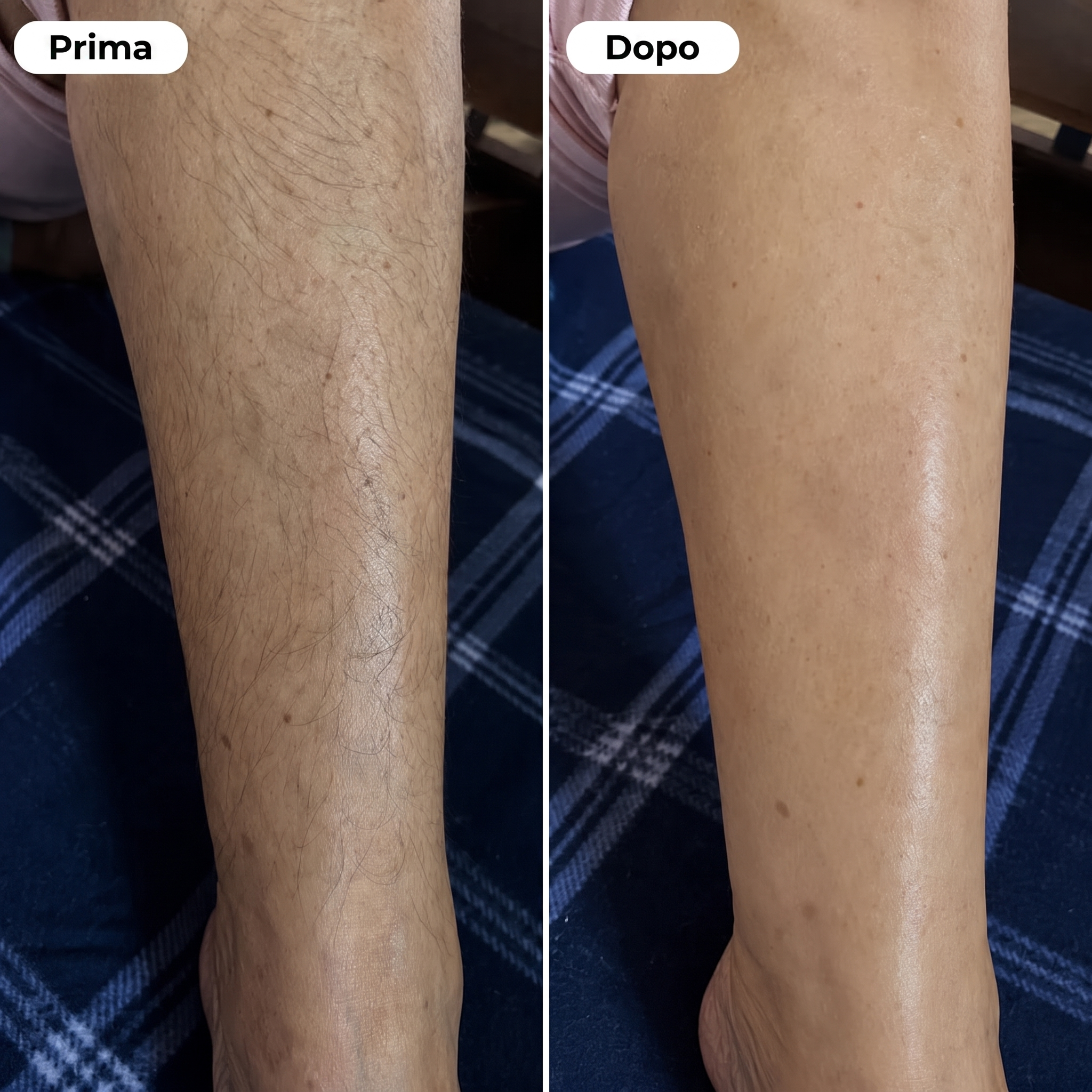 Crema Depilatoria Corpo e Intimo – Pelle Liscia Senza Rasoio