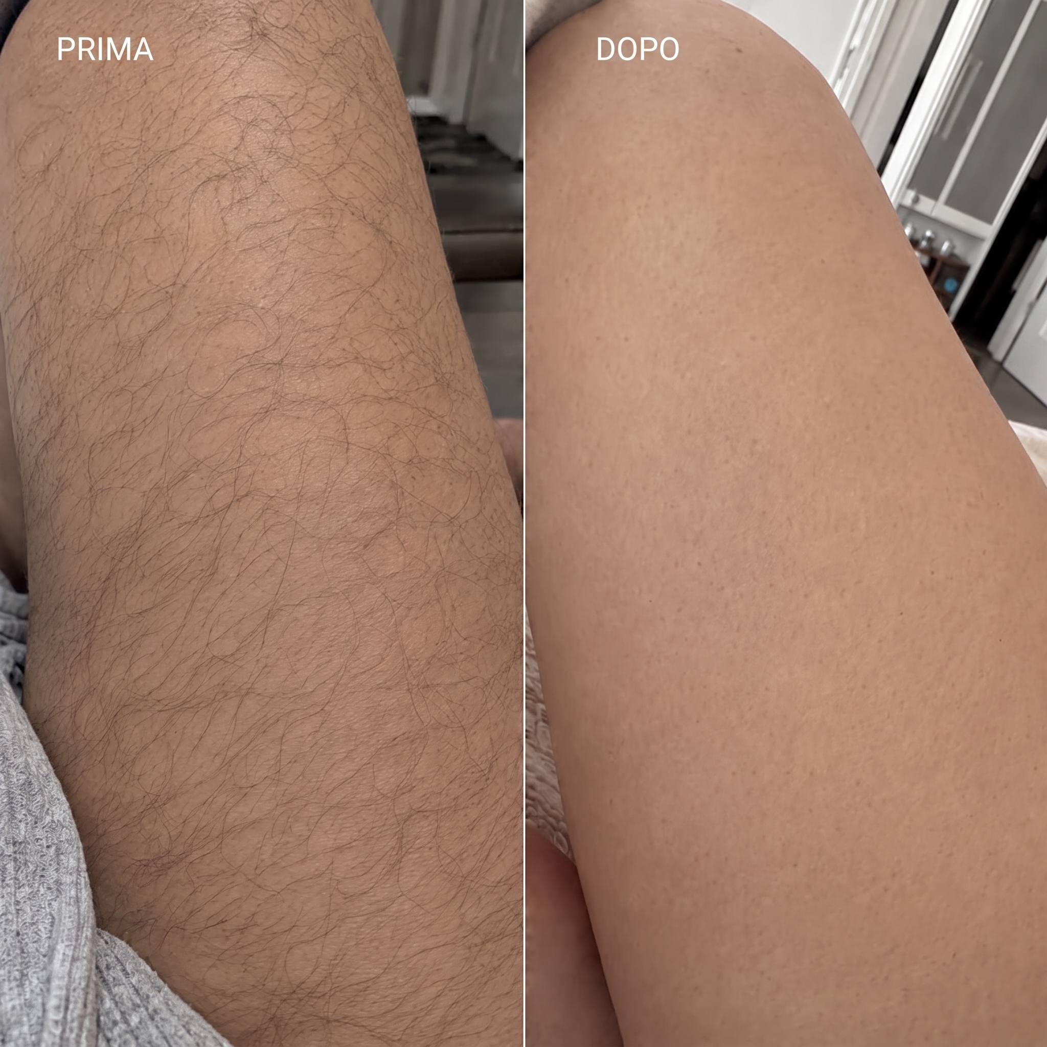 Crema Depilatoria Corpo e Intimo – Pelle Liscia Senza Rasoio