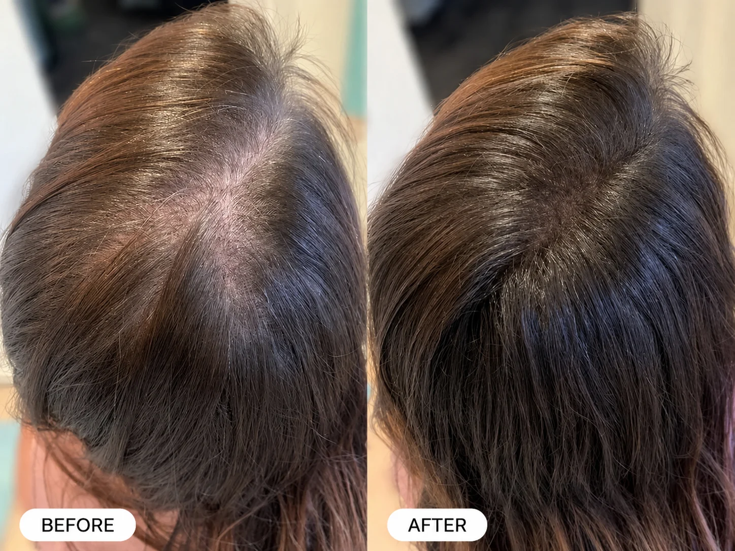 Letili Repair Spray — Eliminates Thinning Hair
