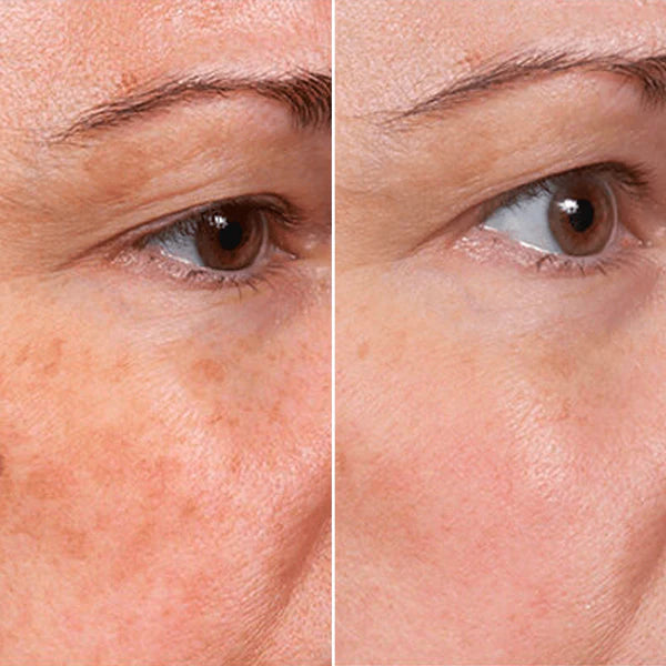 Letili Face Serum